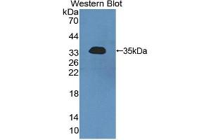 Figure. (SGK2 Antikörper  (AA 40-311))