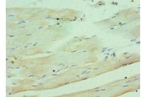 Immunohistochemistry of paraffin-embedded human skeletal muscle tissue using ABIN7148336 at dilution of 1:100 (C1QB Antikörper  (AA 104-253))