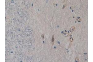 Detection of FABP9 in Rat Spinal cord Tissue using Polyclonal Antibody to Fatty Acid Binding Protein 9, Testis (FABP9) (FABP9 Antikörper  (AA 1-130))