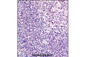 Immunohistochemistry (Paraffin-embedded Sections) (IHC (p)) image for anti-Acidic (Leucine-Rich) Nuclear phosphoprotein 32 Family, Member A (ANP32A) (AA 133-162) antibody (ABIN657650)