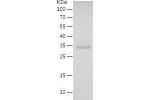 Western Blotting (WB) image for Filamin Binding LIM Protein 1 (FBLIM1) (AA 1-200) protein (His tag) (ABIN7122967) (FBLIM1 Protein (AA 1-200) (His tag))