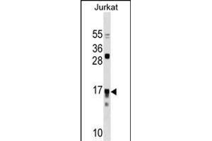 IL17RC Antibody (N-term) (ABIN1538937 and ABIN2850039) western blot analysis in Jurkat cell line lysates (35 μg/lane). (IL17RC Antikörper  (N-Term))
