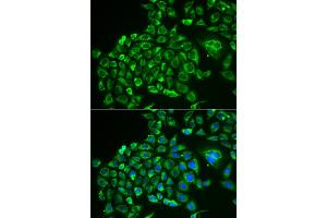 Immunofluorescence analysis of MCF-7 cells using RCVRN antibody.