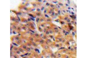 IHC-P analysis of Ovary tissue, with DAB staining. (CCL27 Antikörper  (AA 25-112))