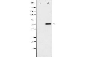 Western blot analysis of MITF phosphorylation expression in COS7 whole cell lysates,The lane on the left is treated with the antigen-specific peptide.