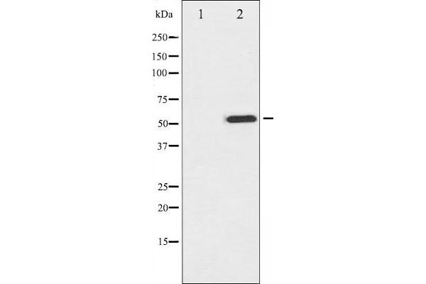 MITF antibody  (pSer73, pSer180)