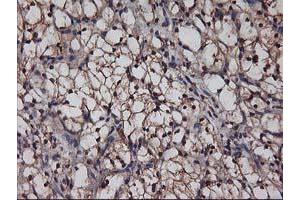 Image no. 7 for anti-V-Akt Murine Thymoma Viral Oncogene Homolog 1 (AKT1) antibody (ABIN1496558) (AKT1 Antikörper)