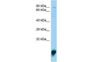 Host:  Rabbit  Target Name:  Pla2g12a  Sample Type:  Rat Spleen lysates  Antibody Dilution:  1.