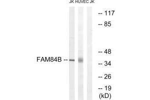 Western blot analysis of extracts from Jurkat cells and HUVEC cells, using FAM84B antibody. (FAM84B Antikörper  (N-Term))