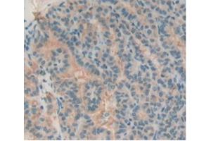 Immunohistochemistry (IHC) image for anti-T Cell Immunoreceptor with Ig and ITIM Domains (TIGIT) (AA 21-234) antibody (ABIN7439486)
