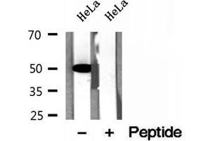 Western blot analysis of extracts of HeLa cells, using GLUD1 antibody. (GLUD1 Antikörper  (Internal Region))