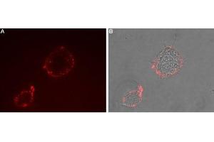 Expression of TRPV3 in rat PC12 cells - Cell surface detection of TRPV3 in intact living rat pheochromocytoma (PC12) cells.