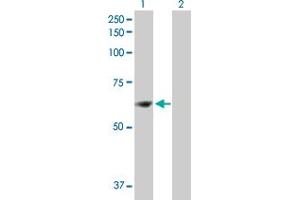 Western Blot analysis of ZNF599 expression in transfected 293T cell line by ZNF599 MaxPab polyclonal antibody. (ZNF599 Antikörper  (AA 1-588))