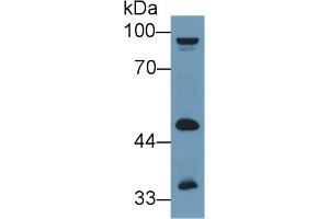 Western Blotting (WB) image for anti-Glutamic Pyruvate Transaminase (Alanine Aminotransferase) 2 (GPT2) (AA 210-300) antibody (ABIN7435643)