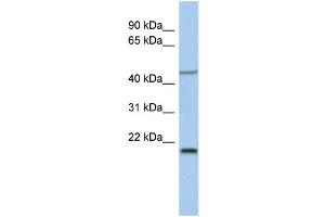 WB Suggested Anti-KLF15 Antibody Titration:  0. (KLF15 Antikörper  (Middle Region))