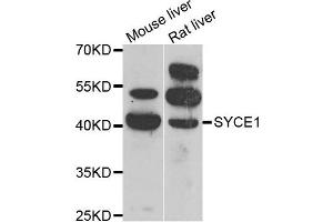 Western blot analysis of extracts of mouse liver and rat liver cell lines, using SYCE1 antibody. (SYCE1 Antikörper)