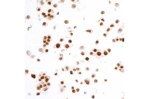 anti-Fused in Sarcoma (FUS) (AA 1-50) antibody
