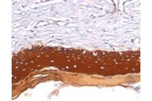 Immunohistochemical staining (Formalin-fixed paraffin-embedded sections) analysis of human skin with Pan Cytokeratin monoclonal antibody, clone AE1 + AE3  at 1:200 using peroxidase-conjugate and DAB chromogen. (Keratin 77 Antikörper)