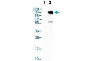 Western blot analysis of Lane 1: Negative control (vector only transfected HEK293T lysate) and Lane 2: Over-expression lysate (Co-expressed with a C-terminal myc-DDK tag (~3. (TAO Kinase 3 Antikörper  (AA 323-432))
