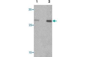 Western blot analysis of rat spleen tissue lysate with CLEC7A polyclonal antibody  at (1) 1 and (2) 2 ug/mL. (CLEC7A Antikörper  (Internal Region))