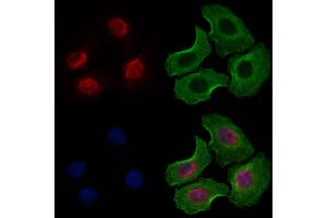 ABIN6263656 and ABIN6277487 staining Hela cells by IF/ICC.
