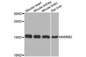 Western blot analysis of extracts of various cell lines, using MSRB2 antibody. (MSRB2 Antikörper  (AA 10-182))