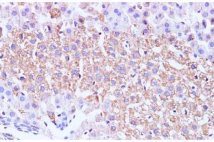 Immunohistochemistry of paraffin-embedded Mouse liver using GCK Polyclonal Antibody at dilution of 1:100 (GCK Antikörper)