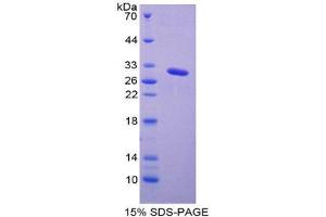 SDS-PAGE (SDS) image for Galactosidase, alpha (GLA) (AA 29-258) protein (His tag) (ABIN2124900)