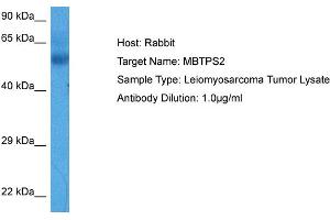 Host:  Rabbit  Target Name:  MBTPS2  Sample Tissue:  Human Leiomyosarcoma Tumor lysates  Antibody Dilution:  1ug/ml (MBTPS2 Antikörper  (N-Term))