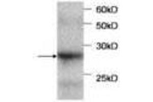 Image no. 1 for anti-serpin Peptidase Inhibitor, Clade B (Ovalbumin), Member 4 (SERPINB4) antibody (ABIN791514) (SERPINB4 Antikörper)