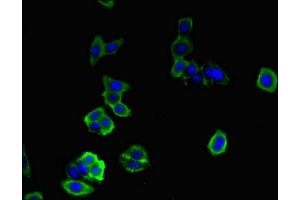 Immunofluorescent analysis of HepG2 cells using ABIN7149599 at dilution of 1:100 and Alexa Fluor 488-congugated AffiniPure Goat Anti-Rabbit IgG(H+L) (DOCK7 Antikörper  (AA 1440-1671))