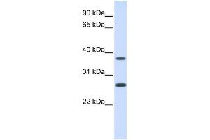 FAM156A antibody used at 1 ug/ml to detect target protein. (FAM156A Antikörper  (N-Term))