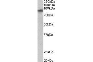 Western Blotting (WB) image for anti-Zinc Finger Protein 652 (ZNF652) (C-Term) antibody (ABIN2464976) (ZNF652 Antikörper  (C-Term))