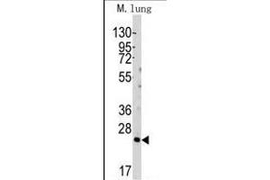 Western Blotting (WB) image for anti-BH3 Interacting Domain Death Agonist (BID) (AA 68-103) antibody (ABIN388099)