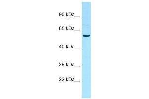 Host:  Rabbit  Target Name:  Ddx19b  Sample Type:  Rat Testis lysates  Antibody Dilution:  1. (DDX19B Antikörper  (N-Term))