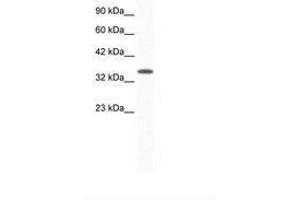 Image no. 1 for anti-Aryl Hydrocarbon Receptor Interacting Protein (AIP) (AA 99-148) antibody (ABIN202263) (AIP Antikörper  (AA 99-148))