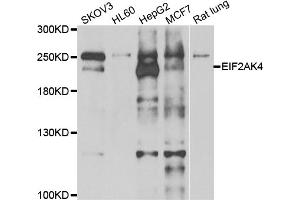 Western blot analysis of extracts of various cell lines, using EIF2AK4 antibody (ABIN5974303) at 1/1000 dilution. (GCN2 Antikörper)