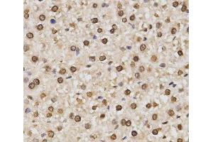 Immunohistochemistry of paraffin-embedded Rat liver using DiMethyl-Histone H3-K14 Polyclonal Antibody at dilution of 1:200 (40x lens). (Histone 3 Antikörper  (2meLys14))