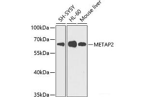 Western blot analysis of extracts of various cell lines using METAP2 Polyclonal Antibody at dilution of 1:1000. (METAP2 Antikörper)