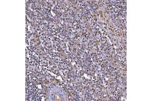 IHC analysis of TOP3B using anti-TOP3B antibody (ABIN7599907). (TOP3B Antikörper  (AA 128-824))