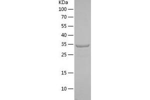 JAK2 Protein (AA 241-351) (His-IF2DI Tag)