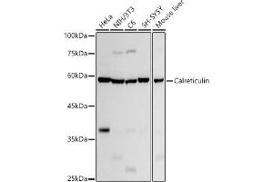 Western blot analysis of extracts of various cell lines, using Calreticulin antibody (ABIN7266042) at 1:1000 dilution. (Calreticulin Antikörper)