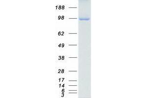Western Blotting (WB) image for Protein Kinase D1 (PRKD1) protein (Myc-DYKDDDDK Tag) (ABIN2729632)