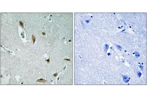Immunohistochemical staining of paraffin-embedded human brain tissue reacted with AKT1/AKT3 (phospho Y437/Y434) polyclonal antibody  at 1:50-1:100 dilution. (AKT1/3 (pTyr437), (Tyr434) Antikörper)
