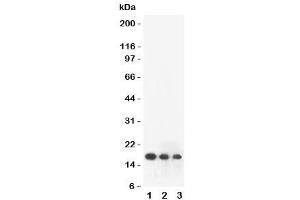 Western blot testing of FGF2 antibody and human recombinant protein: 1) 10ng/lane, 2) 5ng/lane, 3) 2. (FGF2 Antikörper  (AA 143-288))
