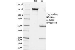 SDS-PAGE Analysis of Purified, BSA-Free Estrogen Inducible Protein pS2 Antibody (clone GE2). (TFF1 Antikörper  (C-Term))