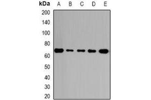 Western blot analysis of GalNAc-T2 expression in HepG2 (A), A431 (B), mouse lung (C), rat kidney (D), rat brain (E) whole cell lysates. (GalNAc-T2 Antikörper)