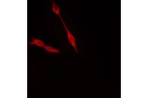 ABIN6274372 staining Hela cells by IF/ICC. (TRIP4 Antikörper  (N-Term))