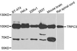 Western blot analysis of extracts of various cell lines, using TRPC3 antibody (ABIN5995383) at 1/500 dilution. (TRPC3 Antikörper)