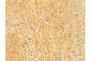ABIN7094321 and ABIN7098368 at 1/100 staining Mouse heart tissue by IHC-P. (KIF19 Antikörper  (Internal Region))
